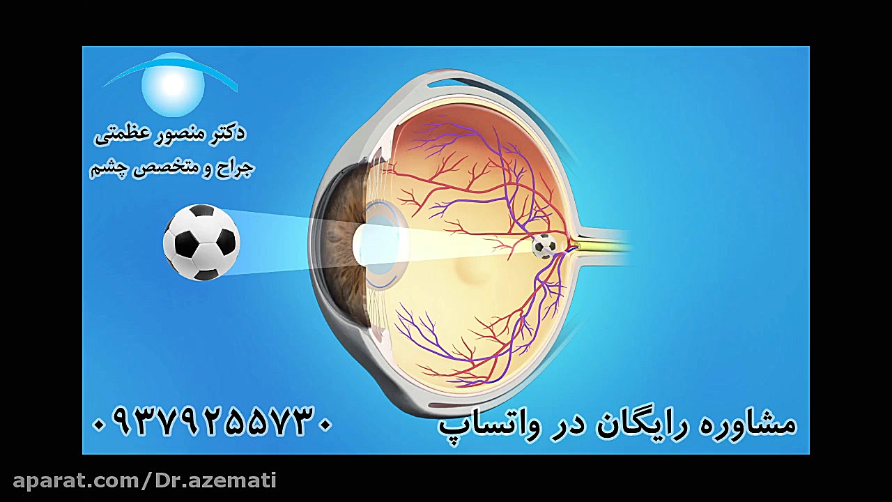 لیزر تمیز کردن لنز آب مروارید زیبایی پوست
