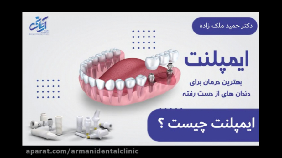ایمپلنت دندانی چیست ؟ ( دکتر حمید ملک زاده متخصص جراحی فک و صورت ) Microarray