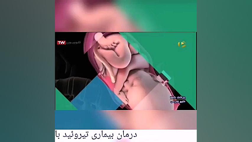 درمان تیروئید کم کار و تیروئید پرکار با طب سنتی تزریق بوتاکس