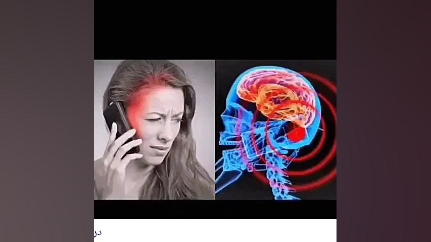 درمان دیسک کمر و آرتروز بدون جراحی؟ روکش دندان