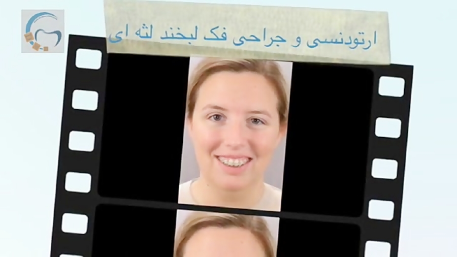 ارتودنسی و جراحی فک لبخند لثه ای | دکتر مسعود داوودیان Förster Resonance Energy Transfer Test