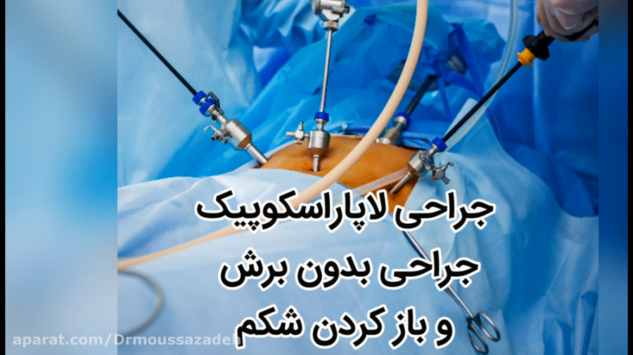 جراحی لاپاراسکوپیک جراحی بدون برش پوست پزشکی کانابینوئید
