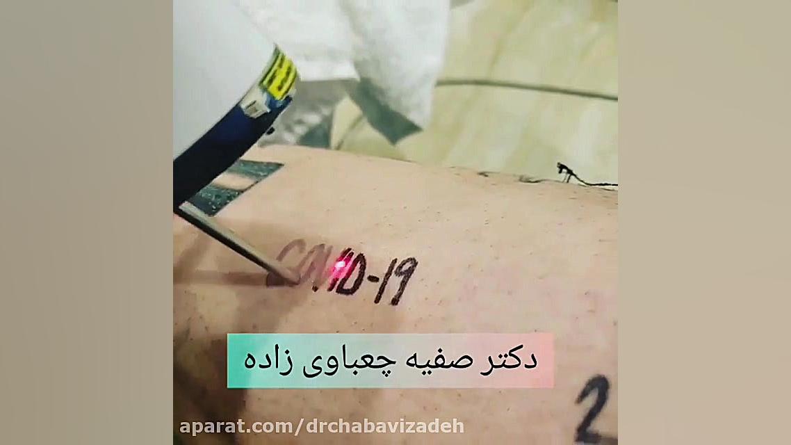 ویدیویی از کووید19-دکترصفیه چعباوی زاده دکتر صفیه چعباوی زاده