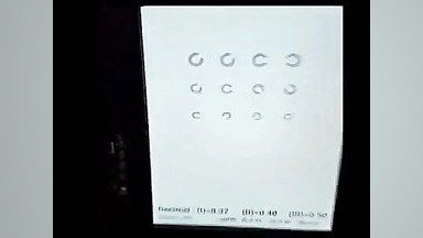 تنظیم کنتراست/نور پس زمینه/کالیبراسیون دستگاه ivision جراحی گوش