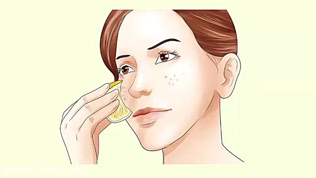 درمان لک قهوه ای پوست با ضد لک های گیاهی و خانگی کشیدن دندان