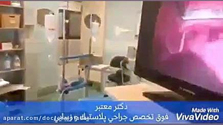 جراحی لیفت ابرو دستگاه پلاسمای سرد