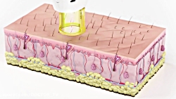 لیزر موی زاید لیزرالکس ویدیولی...