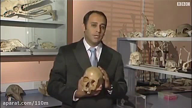 نژاد ایرانیان مایکروگناتیا