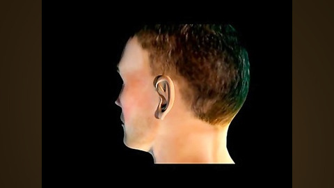 Ear surgery animation by dr.emami دکتر علیرضا امامی