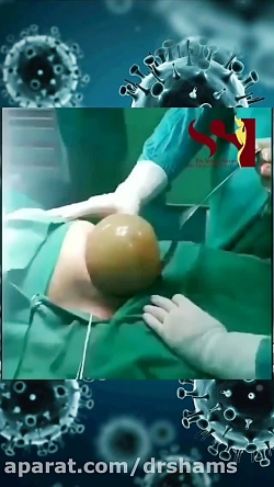 بارداری و ویروس کرونا