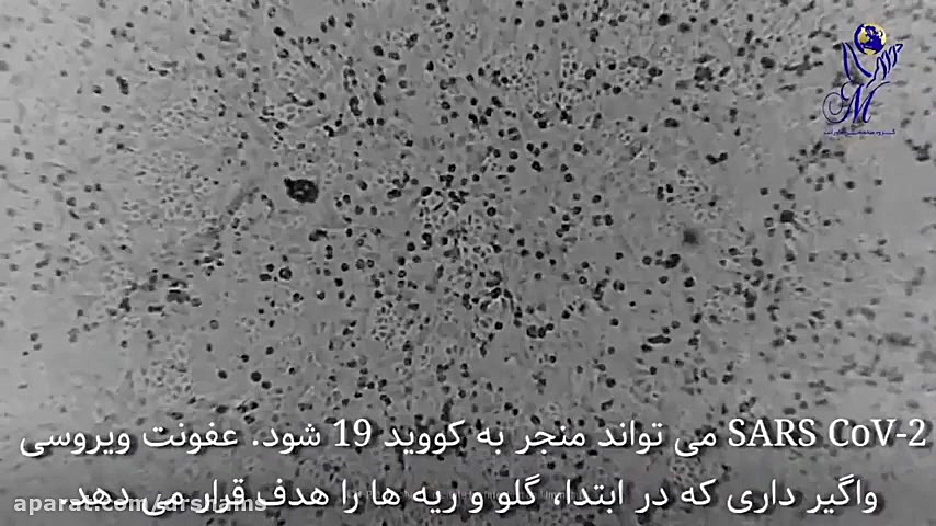 میزان مرگ و میر ناشی از کرونا در آقایان بیشتر از خانم ها میباشد دکتر شیرین شمس جراح و متخصص زنان و زایمان