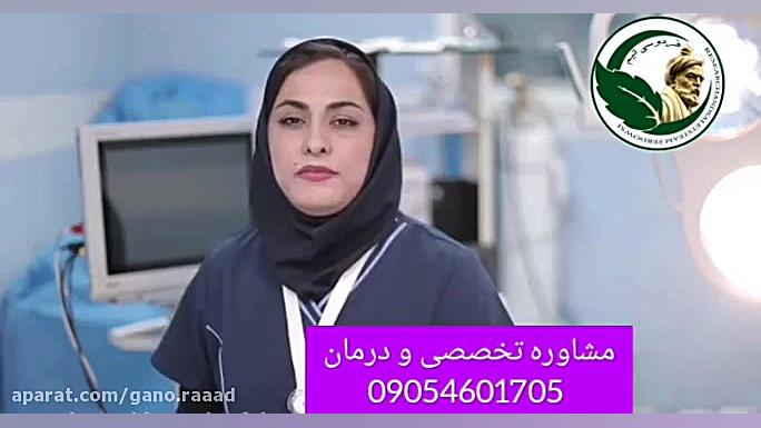 علت اصلی سندروم تخمدان پلی کیستیک و تنبلی تخمدان ماموپلاستی