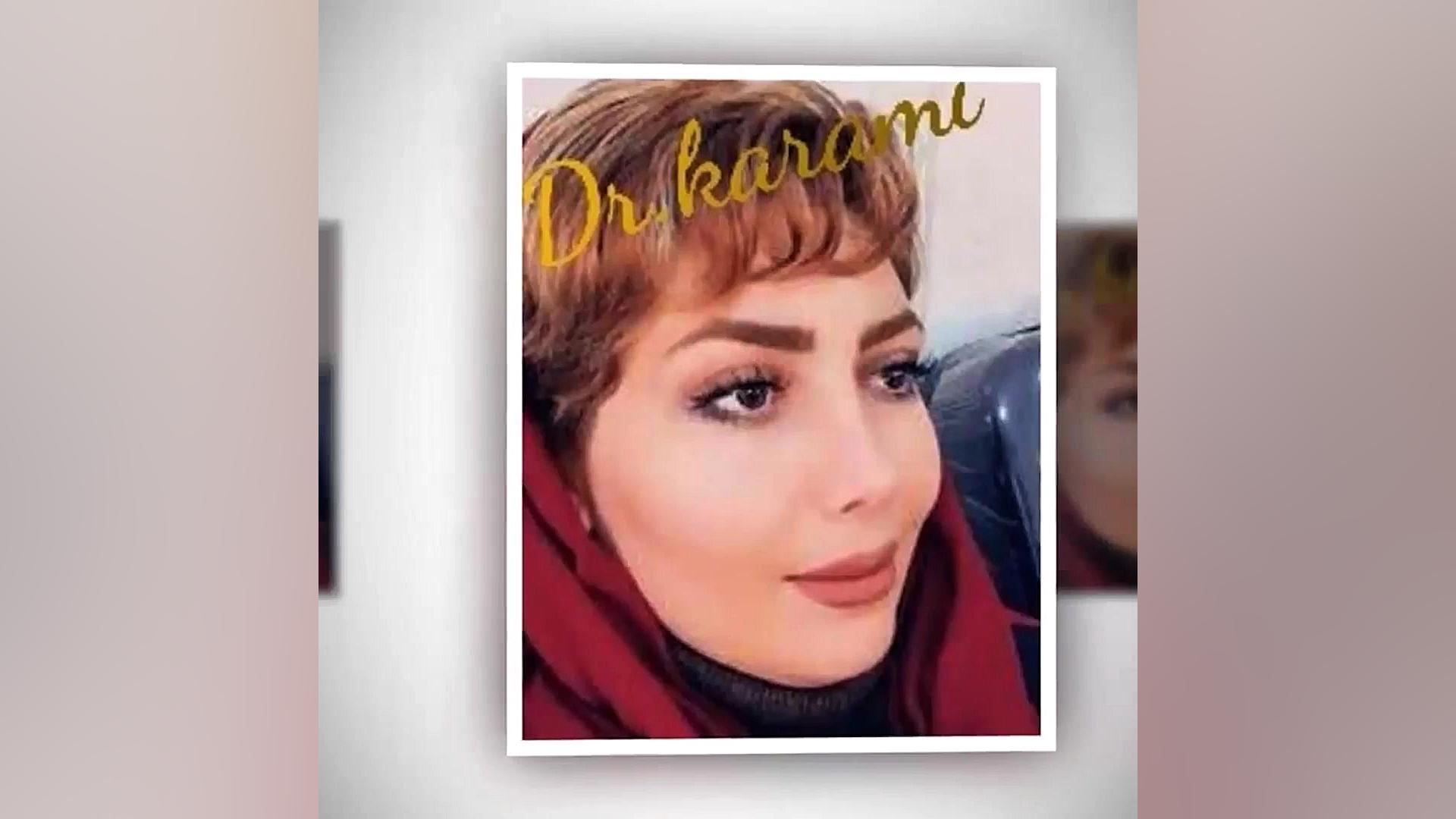 نمونه های جراحی بینی دکتر دنیا کرمی جراح بینی شیراز رفع افتادگی پلک