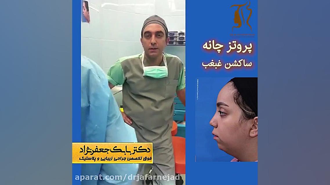 پروتز چانه و ساکشن غبغب دکتر بابک جعفرنژاد