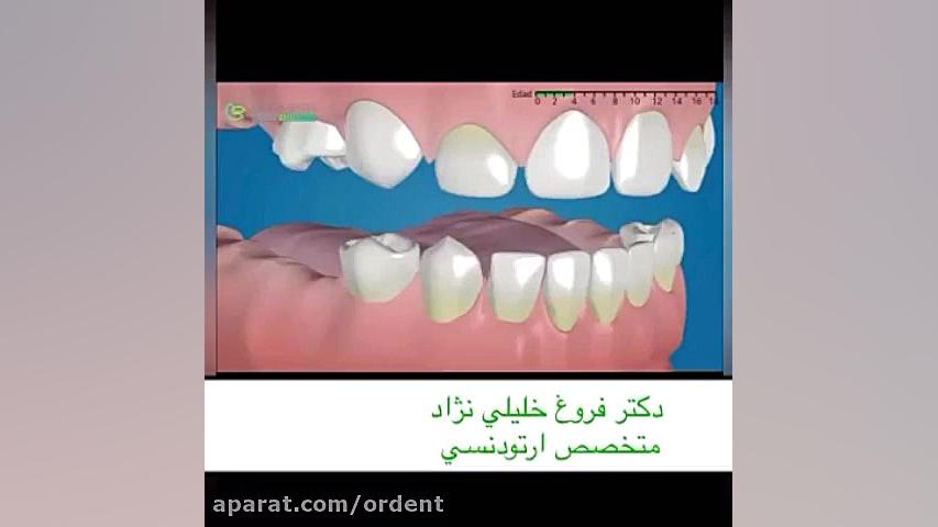 روند رويش دندان شيري و دايمي دكتر فروغ خليلي نژاد