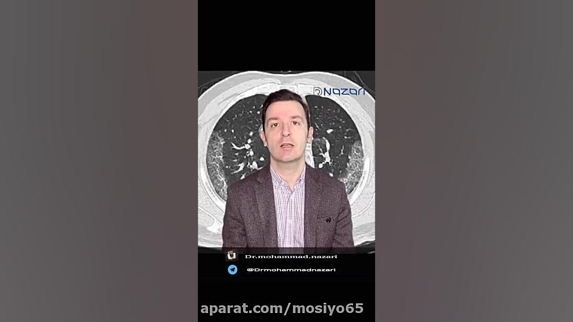 توضیحات کامل دکتر نظری درباره CT Scanقفسه سینه در مبتلایان به کرونا ترمیم سوختگی