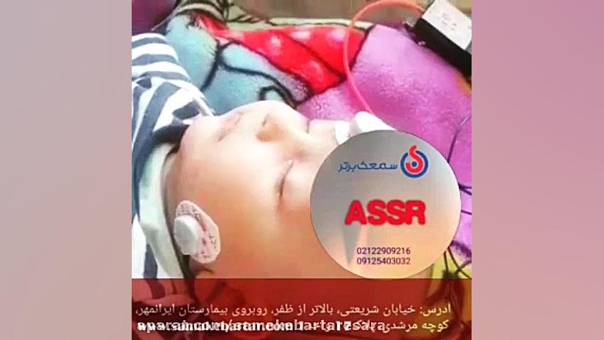 تست شنوایی assr_ سمعک برتر 02122909216 ترمیم سوختگی