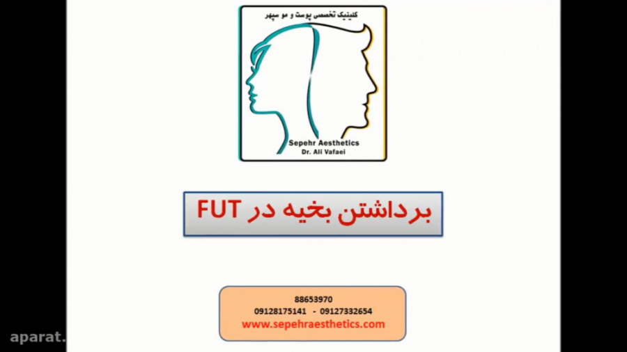 برداشتن بخیه در روش FUT دکتر علی وفائی - متخصص پوست و مو