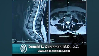 نحوه خواندن MRI ستون فقرات مورگان فریمن