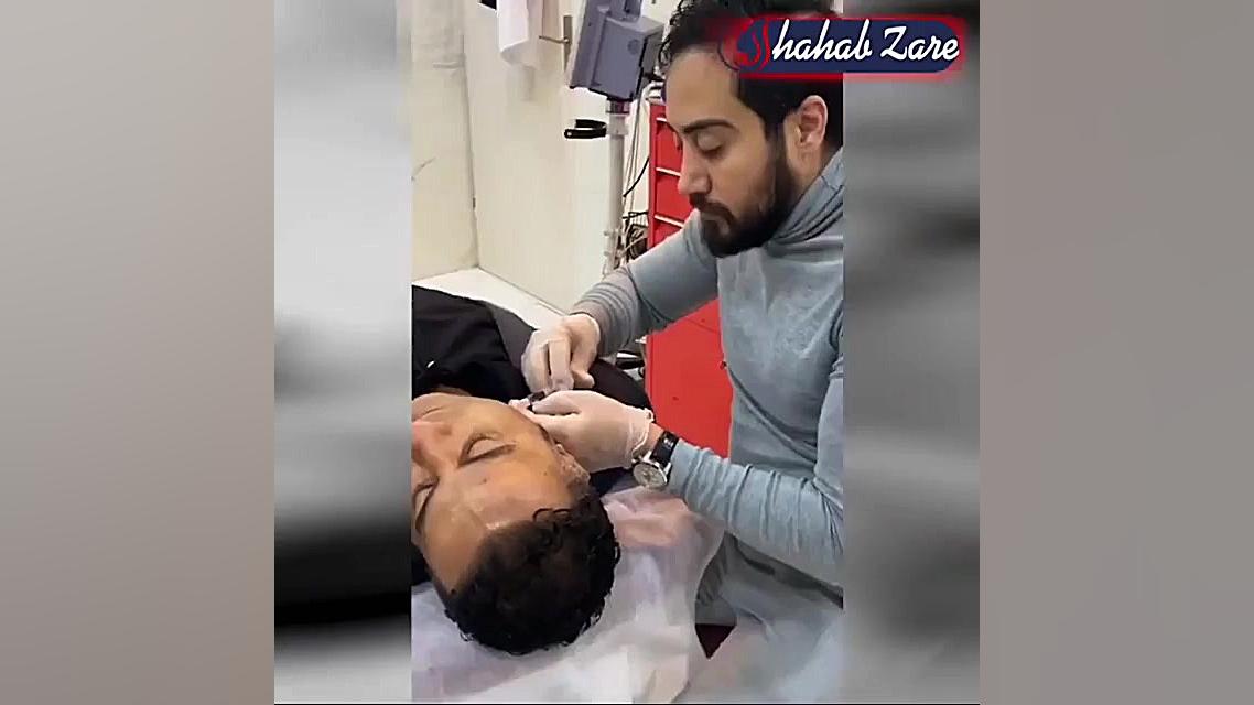 ویدئو تزریق پروفایلو | جوانسازی پوست در شیراز | دکتر شهاب زارع بیماری کاوازاکی