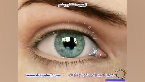 اهمیت خشکی چشم - مرکز چشم پزشکی دکتر علیرضا نادری مرکز چشم پزشکی دکتر علیرضا نادری www.dr-naderi.com
