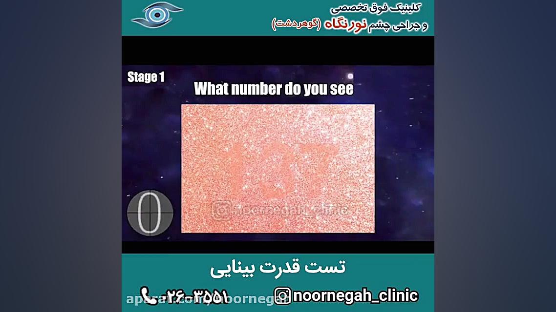 تست قدرت بینایی ترمیم دندان