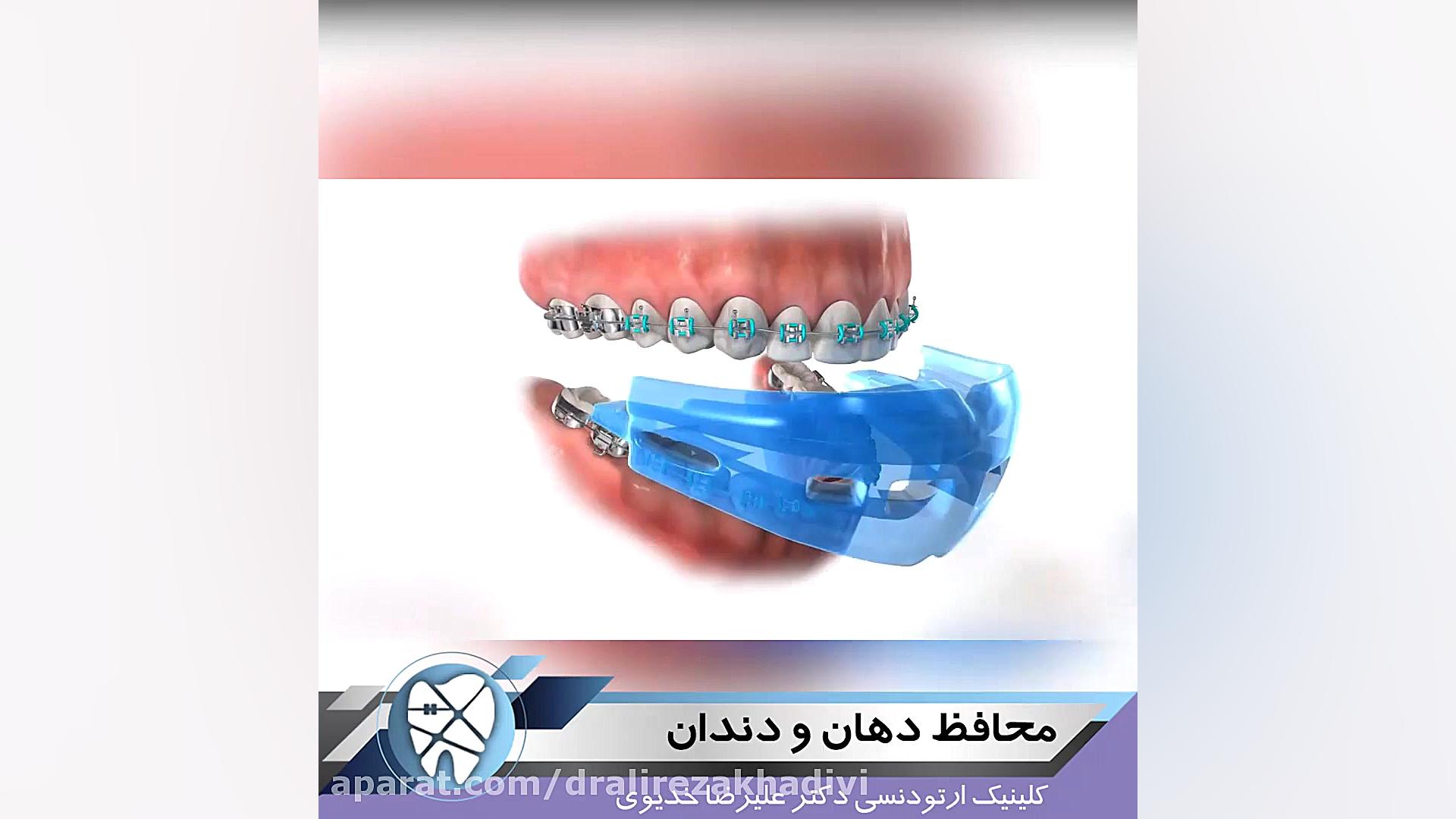 محافظ دهان و دندان،متخصص ارتودنسی،دکترعلیرضاخدیوی دکتر علیرضا خدیوی