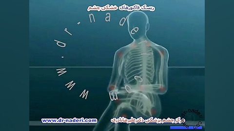 ریسک فاکتورخشکی چشم -مرکز چشم پزشکی دکتر علیرضانادری مرکز چشم پزشکی دکتر علیرضا نادری www.dr-naderi.com