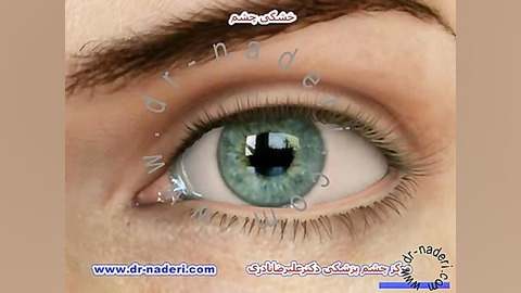 خشکی چشم - مرکز چشم پزشکی دکتر علیرضا نادری مرکز چشم پزشکی دکتر علیرضا نادری www.dr-naderi.com