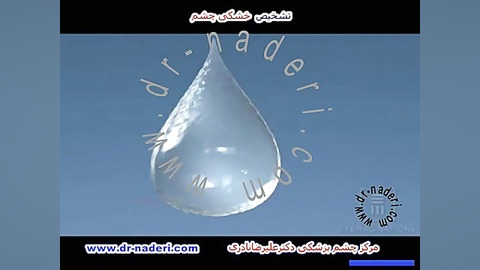 تشخیص خشکی چشم - مرکز چشم پزشکی دکتر رضا نادری مرکز چشم پزشکی دکتر علیرضا نادری www.dr-naderi.com
