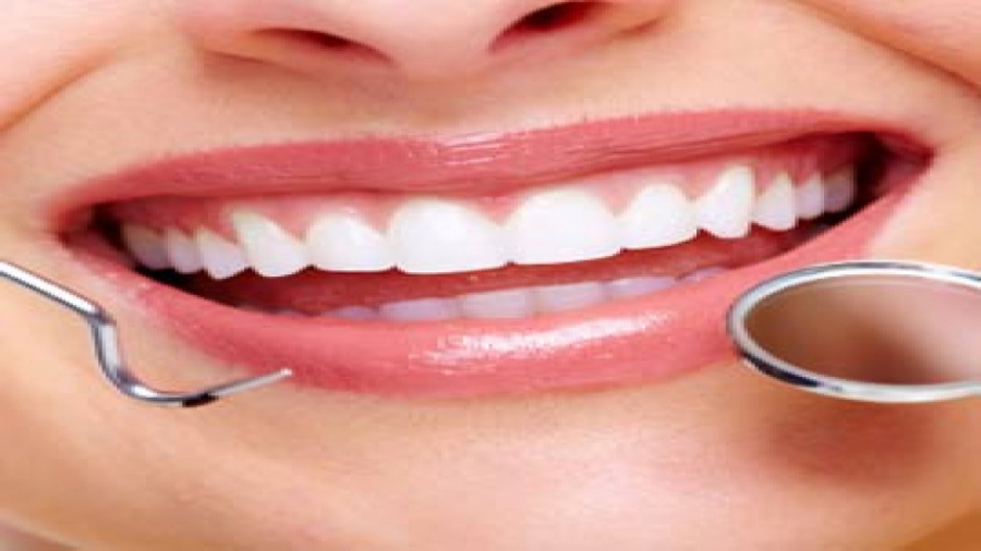 اصلاح طرح لبخند دکتر ندا هادی-دندانپزشک زیبایی