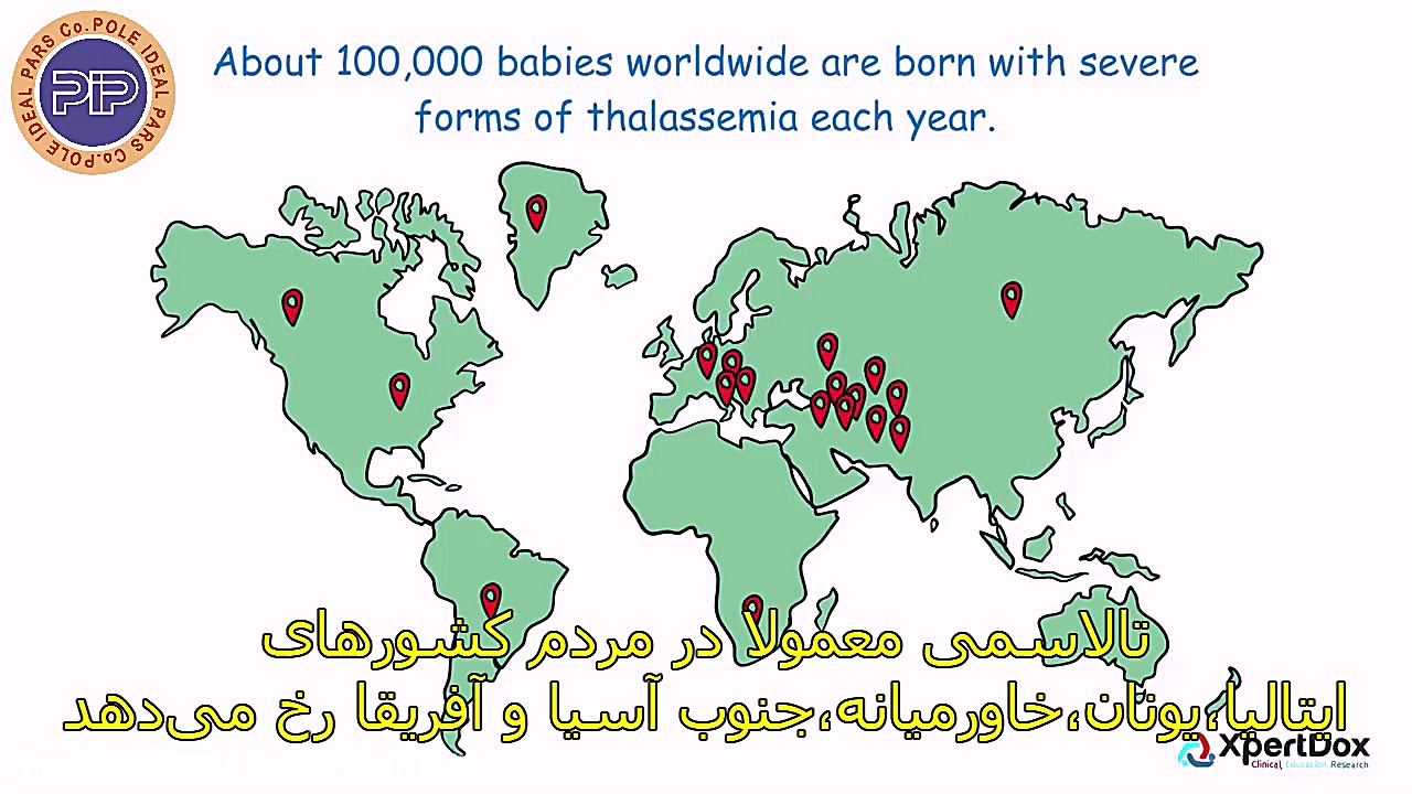 بیماری تالاسمی، یک اختلال خونی ارثی دستگاه پلاسمای سرد