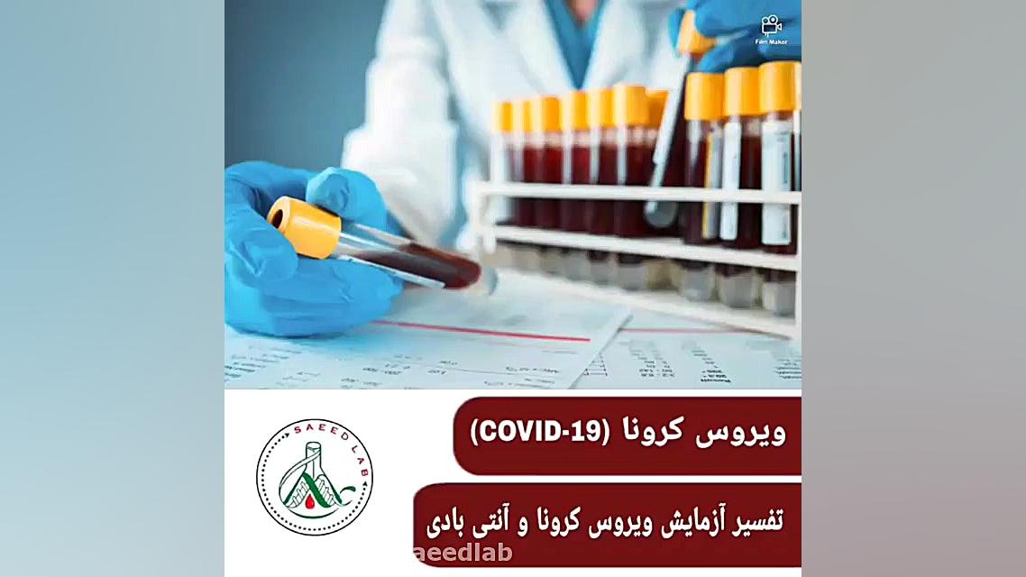 تفسیر آزمایش ویروس کرونا و آنتی بادی لیزر مو