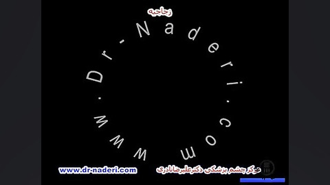 زجاجیه -ساختمان چشم-مرکز چشم پزشکی دکتر علیرضا نادری مرکز چشم پزشکی دکتر علیرضا نادری www.dr-naderi.com