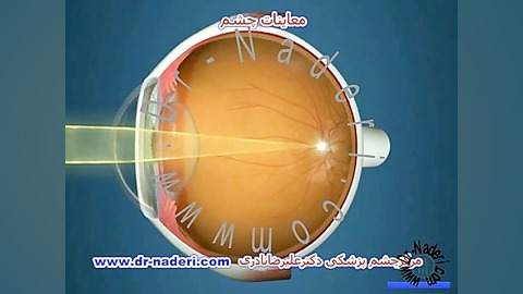 اهمیت معاینات چشم-مرکز چشم پزشکی دکتر علیرضا نادری مرکز چشم پزشکی دکتر علیرضا نادری www.dr-naderi.com