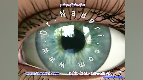 معاینه شبکیه - مرکزچشم پزشکی دکتر علیرضا نادری مرکز چشم پزشکی دکتر علیرضا نادری www.dr-naderi.com