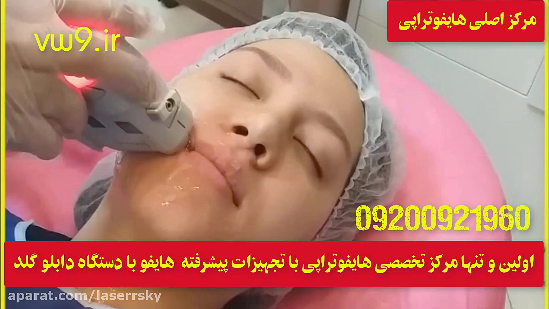 هایفوتراپی رفع چین و چروک صورت گردن پیشانی مزوتراپی