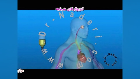 آنژیوگرافی شبکیه - مرکزچشم پزشکی دکتر علیرضا نادری مرکز چشم پزشکی دکتر علیرضا نادری www.dr-naderi.com