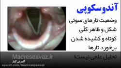 ویدئوی تارهای صوتی ترمیم زیبایی دندان