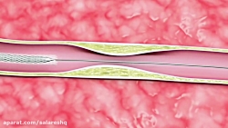 ده ماده خوراکی برای پاکسازی عر...