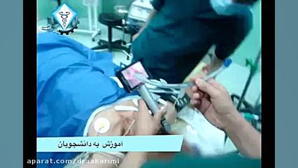 معرفی ویدیو لارینگوسکوپ دکتر علی اصغر کریمی