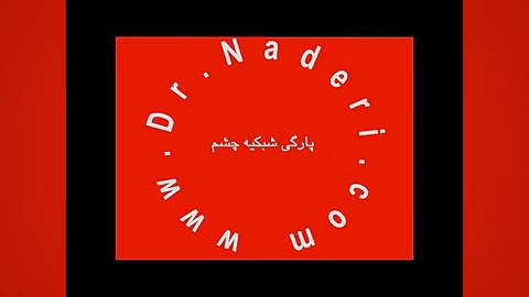 پارگی شبکیه Tear - مرکزچشم پزشکی دکتر علیرضا نادری مرکز چشم پزشکی دکتر علیرضا نادری www.dr-naderi.com
