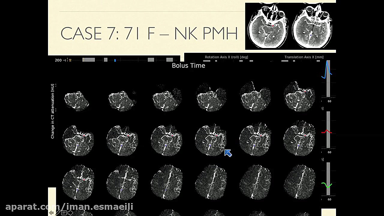 مجموعه فیلم آموزشی – 2020 Neuroradiology in Clinical Practice زمان64ثانیه