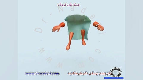 عینک با شیشه پلی کربنات - مرکز چشم پزشکی دکتر نادری مرکز چشم پزشکی دکتر علیرضا نادری www.dr-naderi.com