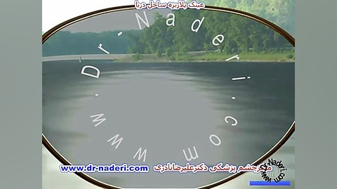 عینک پولاریزه ساحل -مرکز چشم پزشکی دکتر علیرضا نادری مرکز چشم پزشکی دکتر علیرضا نادری www.dr-naderi.com