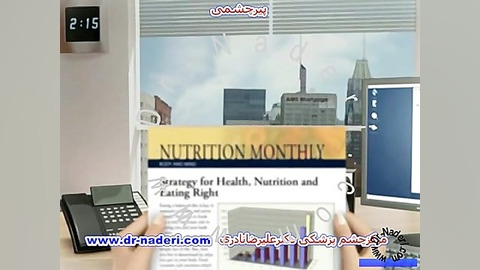 پیرچشمی - مرکز چشم پزشکی دکتر علیرضا نادری مرکز چشم پزشکی دکتر علیرضا نادری www.dr-naderi.com