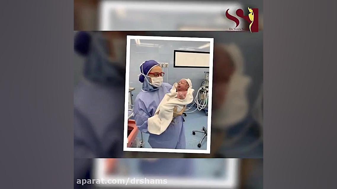 سزارین همراه با مینی ابدومینوپلاستی دکتر شیرین شمس جراح و متخصص زنان و زایمان