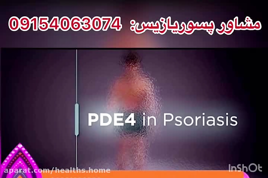 بهبود و درمان بیماری پسوریازیس