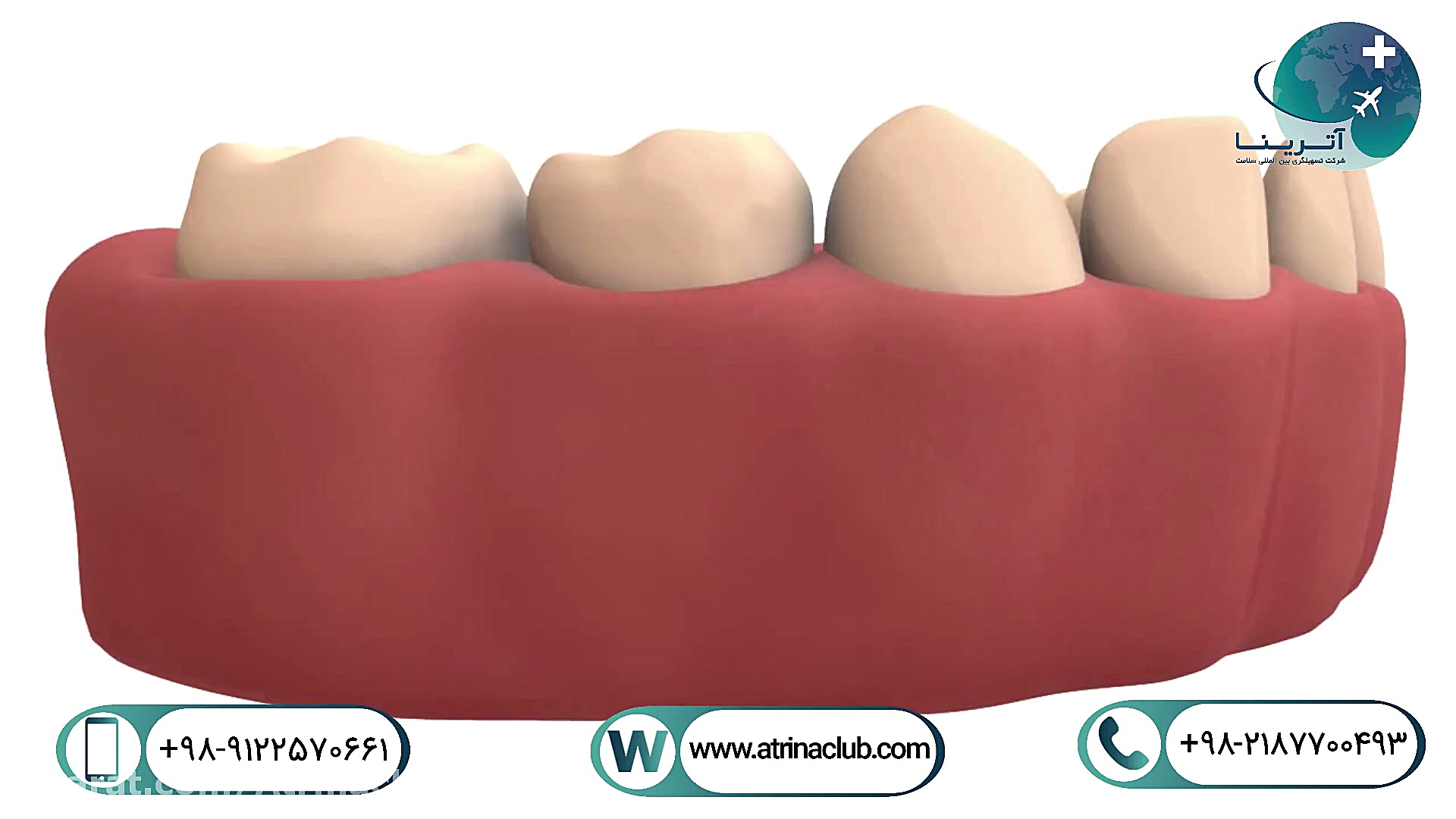 پالپوتومی تست کورتیزول دیورنال