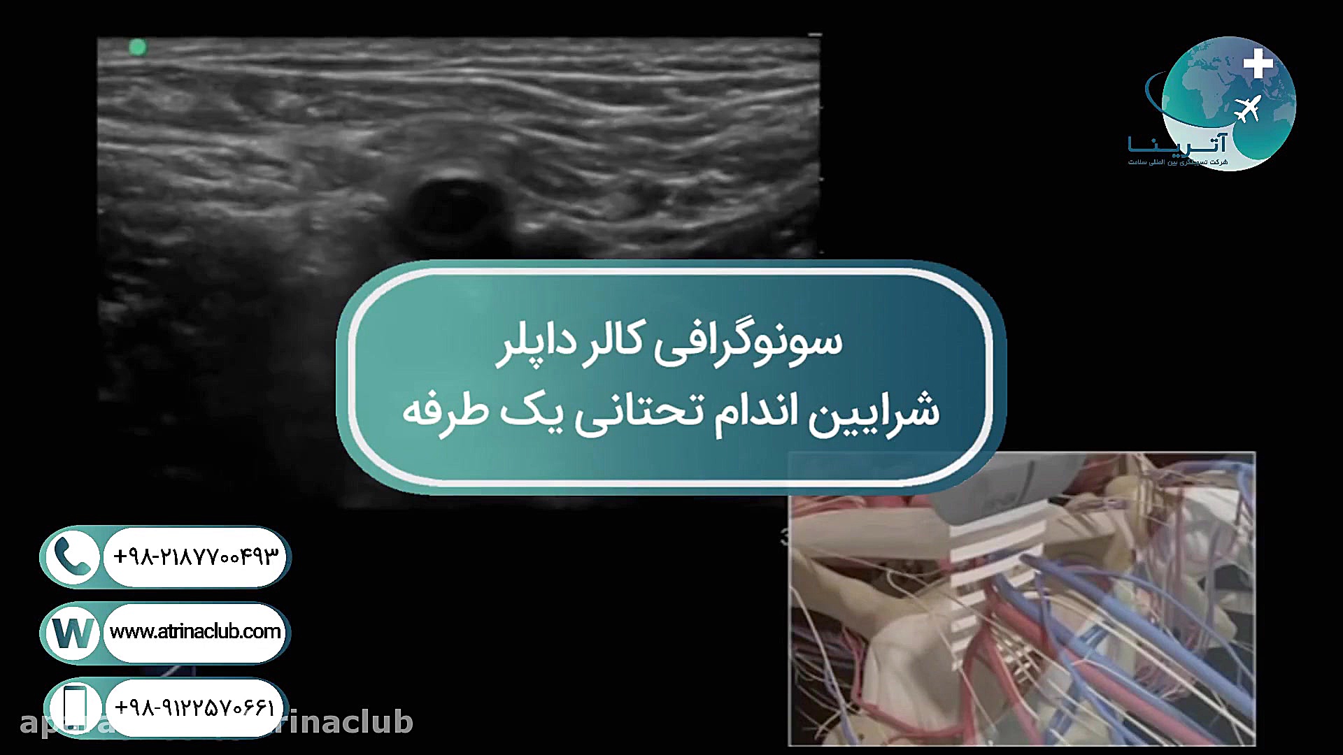 سونوگرافی کالر داپلر شرایین اندام تحتانی یک طرفه جراحی فک